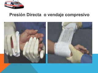 Presión Directa o vendaje compresivo
 
