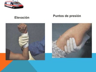 Elevación
Puntos de presión
 