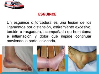 ESGUINCE
Un esguince o torcedura es una lesión de los
ligamentos por distensión, estiramiento excesivo,
torsión o rasgadura, acompañada de hematoma
e inflamación y dolor que impide continuar
moviendo la parte lesionada.
 