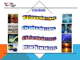 CAUSAS:
 