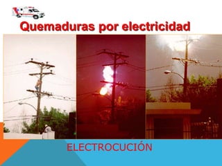 ELECTROCUCIÓN
Quemaduras por electricidad
 