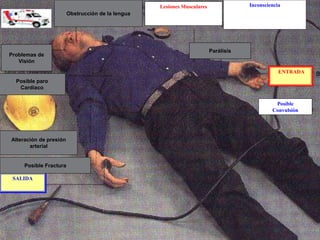 ENTRADA
Posible
Convulsiòn
Inconsciencia
Lesiones Musculares
SALIDA
Parálisis
Obstrucción de la lengua
Problemas de
Visión
Posible paro
Cardiaco
Alteración de presión
arterial
Posible Fractura
 