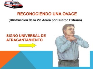 RECONOCIENDO UNA OVACE
SIGNO UNIVERSAL DE
ATRAGANTAMIENTO
(Obstrucción de la Vía Aérea por Cuerpo Extraño)
 