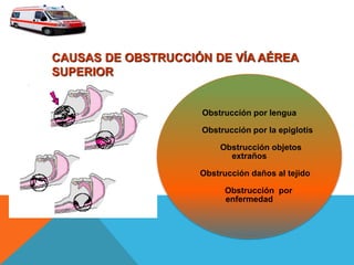CAUSAS DE OBSTRUCCIÓN DE VÍA AÉREA
SUPERIOR
Obstrucción por lengua
Obstrucción por la epiglotis
Obstrucción objetos
extraños
Obstrucción daños al tejido
Obstrucción por
enfermedad
 
