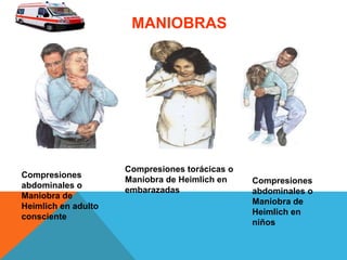 Compresiones
abdominales o
Maniobra de
Heimlich en adulto
consciente
Compresiones torácicas o
Maniobra de Heimlich en
embarazadas
Compresiones
abdominales o
Maniobra de
Heimlich en
niños
MANIOBRAS
 