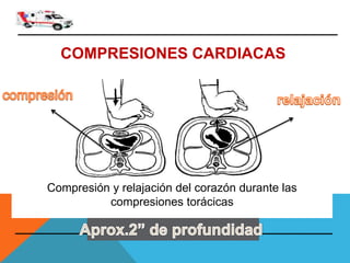 COMPRESIONES CARDIACAS
Compresión y relajación del corazón durante las
compresiones torácicas
 