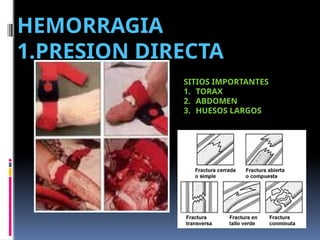 HEMORRAGIA
1.PRESION DIRECTA
SITIOS IMPORTANTES
1. TORAX
2. ABDOMEN
3. HUESOS LARGOS
 