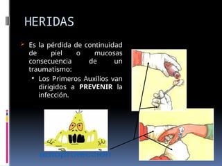 HERIDAS
 Es la pérdida de continuidad
de piel o mucosas
consecuencia de un
traumatismo:

Los Primeros Auxilios van
dirigidos a PREVENIR la
infección.
 