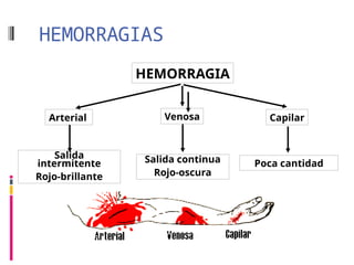 HEMORRAGIAS
HEMORRAGIA
Arterial Venosa Capilar
Salida
intermitente
Rojo-brillante
Salida continua
Rojo-oscura
Poca cantidad
 