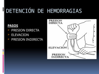 DETENCIÓN DE HEMORRAGIAS
PASOS
 PRESION DIRECTA
 ELEVACION
 PRESION INDIRECTA
 