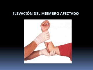 ELEVACIÓN DEL MIEMBRO AFECTADO
 