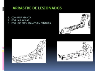 ARRASTRE DE LESIONADOS
1. CON UNA MANTA
2. POR LAS AXILAS
3. POR LOS PIES, MANOS EN CINTURA
 