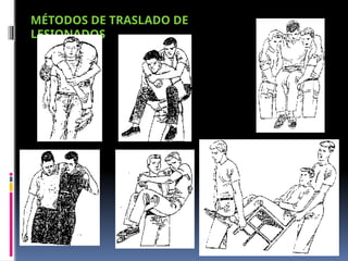 MÉTODOS DE TRASLADO DE
LESIONADOS
 