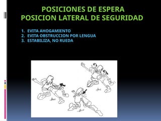 1. EVITA AHOGAMIENTO
2. EVITA OBSTRUCCION POR LENGUA
3. ESTABILIZA, NO RUEDA
POSICIONES DE ESPERA
POSICION LATERAL DE SEGURIDAD
 