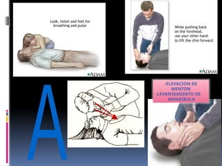 -ELEVACION DE
MENTON
-LEVANTAMIENTO DE
MANDIBULA
 