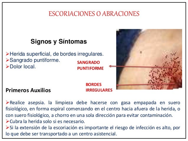 Primeros auxilios básicos