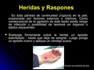 Heridas y Raspones
Es toda pérdida de continuidad (ruptura) en la piel,
ocasionada por factores externos o internos. Como
consecuencia de la agresión de éste tejido existe riesgo
de infección y posibilidad de lesiones en órganos o
tejidos adyacentes.
 Sostenga firmemente sobre la herida un apósito
esterilizado - hasta que deje de sangrar. Luego ponga
un apósito nuevo y aplique un vendaje suave.
Herida con pérdida de piel
 