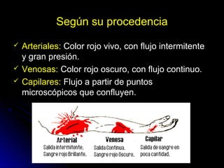 Según su procedencia
 Arteriales:Arteriales: Color rojo vivo, con flujo intermitenteColor rojo vivo, con flujo intermitente
y gran presión.y gran presión.
 Venosas:Venosas: Color rojo oscuro, con flujo continuo.Color rojo oscuro, con flujo continuo.
 Capilares:Capilares: Flujo a partir de puntosFlujo a partir de puntos
microscópicos que confluyen.microscópicos que confluyen.
 