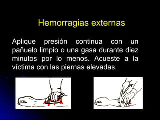 Hemorragias externas
Aplique presión continua con un
pañuelo limpio o una gasa durante diez
minutos por lo menos. Acueste a la
víctima con las piernas elevadas.
 