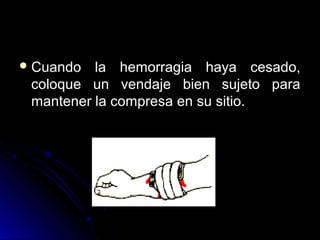 Cuando la hemorragia haya cesado,
coloque un vendaje bien sujeto para
mantener la compresa en su sitio.
 