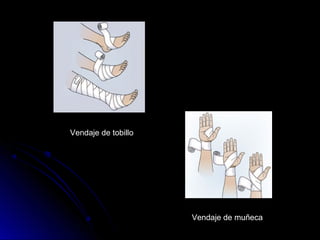 Vendaje de muñeca
Vendaje de tobillo
 