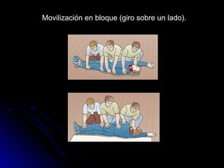 Movilización en bloque (giro sobre un lado).
 