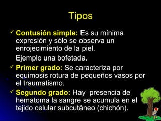 Tipos
 Contusión simple: Es su mínima
expresión y sólo se observa un
enrojecimiento de la piel.
Ejemplo una bofetada.
 Primer grado: Se caracteriza por
equimosis rotura de pequeños vasos por
el traumatismo.
 Segundo grado: Hay presencia de
hematoma la sangre se acumula en el
tejido celular subcutáneo (chichón).
 