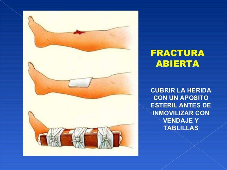 Primeros auxilios dr. glenn