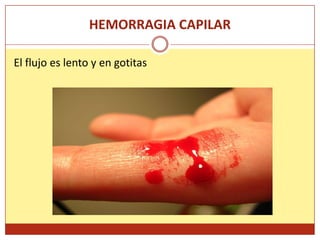 thumbs pro icjswing icjswing tumblr com