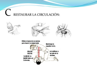 C RESTAURAR LA CIRCULACIÓN:
 