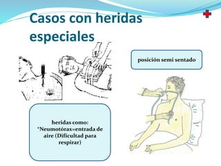 Casos con heridas
especiales
heridas como:
*Neumotórax=entrada de
aire (Dificultad para
respirar)
posición semi sentado
 