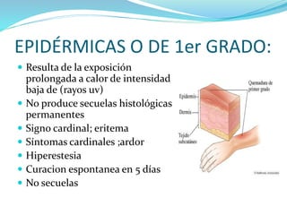 EPIDÉRMICAS O DE 1er GRADO:
 Resulta de la exposición
prolongada a calor de intensidad
baja de (rayos uv)
 No produce secuelas histológicas
permanentes
 Signo cardinal; eritema
 Síntomas cardinales ;ardor
 Hiperestesia
 Curaci0n espontanea en 5 días
 No secuelas
 