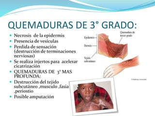 QUEMADURAS DE 3° GRADO:
 Necrosis de la epidermis
 Presencia de vesículas
 Perdida de sensación
(destrucción de terminaciones
nerviosas)
 Se realiza injertos para acelerar
cicatrización
 QUEMADURAS DE 3° MAS
PROFUNDA:
 Destrucción del tejido
subcutáneo ,musculo ,fasia
,periostio
 Posible amputación
 