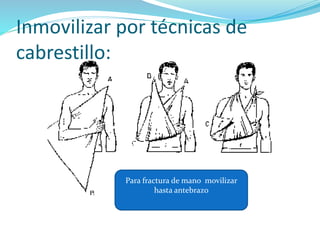 Inmovilizar por técnicas de
cabrestillo:
Para fractura de mano movilizar
hasta antebrazo
 