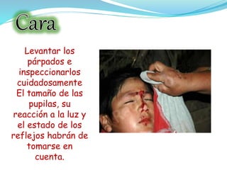 Levantar los
párpados e
inspeccionarlos
cuidadosamente
El tamaño de las
pupilas, su
reacción a la luz y
el estado de los
reflejos habrán de
tomarse en
cuenta.
 