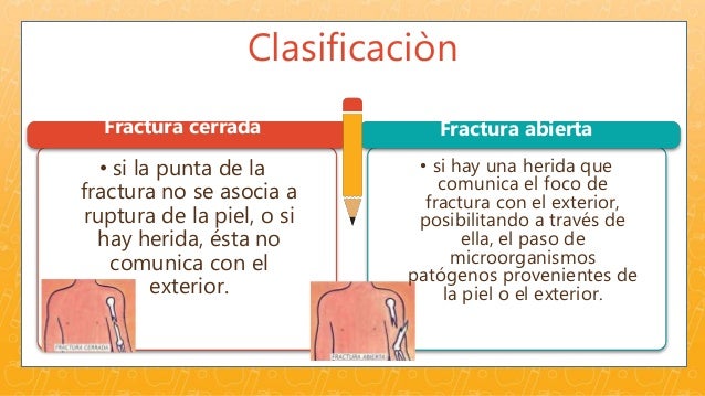 Primeros auxilios- fracturas