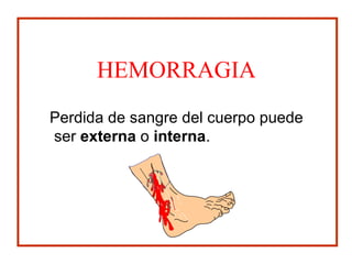 HEMORRAGIA
Perdida de sangre del cuerpo puede
ser externa o interna.
 