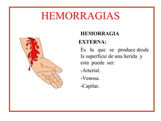 HEMORRAGIA
EXTERNA:
Es la que se produce desde
la superficie de una herida y
esta puede ser:
-Arterial.
-Venosa.
-Capilar.
HEMORRAGIAS
 