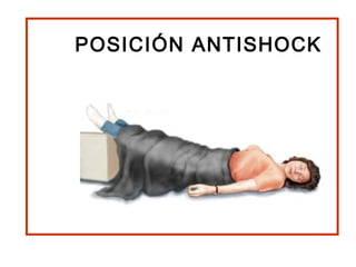 POSICIÓN ANTISHOCK
 