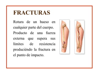 Rotura de un hueso en
cualquier parte del cuerpo.
Producto de una fuerza
externa que supera sus
límites de resistencia
produciéndo la fractura en
el punto de impacto.
FRACTURAS
 