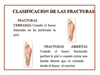 CLASIFICACION DE LAS FRACTURASCLASIFICACION DE LAS FRACTURAS
FRACTURASFRACTURAS
CERRADASCERRADAS Cuando el huesoCuando el hueso
fraturado no ha perforado lafraturado no ha perforado la
piel.piel.
FRACTURAS ABIERTASFRACTURAS ABIERTAS
Cuando el hueso fracturadoCuando el hueso fracturado
perfora la piel o cuando existe unaperfora la piel o cuando existe una
herida abierta que se extiendeherida abierta que se extiende
desde el hueso al exterior.desde el hueso al exterior.
 