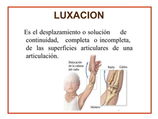 LUXACION
Es el desplazamiento o solución de
continuidad, completa o incompleta,
de las superficies articulares de una
articulación.
 