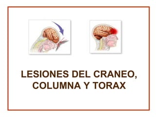 LESIONES DEL CRANEO,
COLUMNA Y TORAX
 
