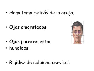 • Hematoma detrás de la oreja.
• Ojos amoratados
• Ojos parecen estar
• hundidos
• Rigidez de columna cervical.
 