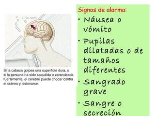 Signos de alarma:
• Náusea o
vómito
• Pupilas
dilatadas o de
tamaños
diferentes
• Sangrado
grave
• Sangre o
secreción
 