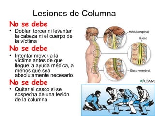 Lesiones de Columna
No se debe
• Doblar, torcer ni levantar
la cabeza ni el cuerpo de
la víctima
No se debe
• Intentar mover a la
víctima antes de que
llegue la ayuda médica, a
menos que sea
absolutamente necesario
No se debe
• Quitar el casco si se
sospecha de una lesión
de la columna
 