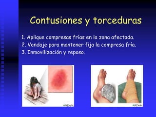 Contusiones y torceduras
1. Aplique compresas frías en la zona afectada.
2. Vendaje para mantener fija la compresa fría.
3. Inmovilización y reposo.
 