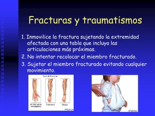 Fracturas y traumatismos
1. Inmovilice la fractura sujetando la extremidad
afectada con una tabla que incluya las
articulaciones más próximas.
2. No intentar recolocar el miembro fracturado.
3. Sujetar el miembro fracturado evitando cualquier
movimiento.
 