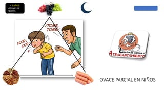 OVACE PARCIAL EN NIÑOS
˂ 5 AÑOS:
NO UVAS NI
FRUTOS
SECOS
 