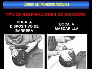 TIPO DE RESPIRACIONES DE SOCORRO BOCA  A DISPOSITIVO DE BARRERA BOCA  A MASCARILLA Curso de Primeros Auxilios 